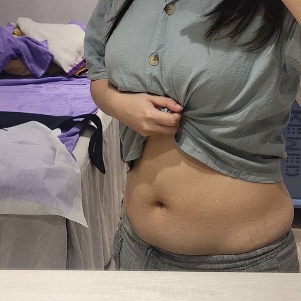 【台北體雕推薦】無痛無恢復期 躺著也能瘦 力美肌塑非侵入式瘦身心得 - 愛爾麗板橋分店 (7).jpg