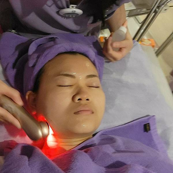 板橋醫美改善膚質美白效果有效嗎台北美白皮秒心得 - 愛爾麗診所板橋分店 (15).jpg