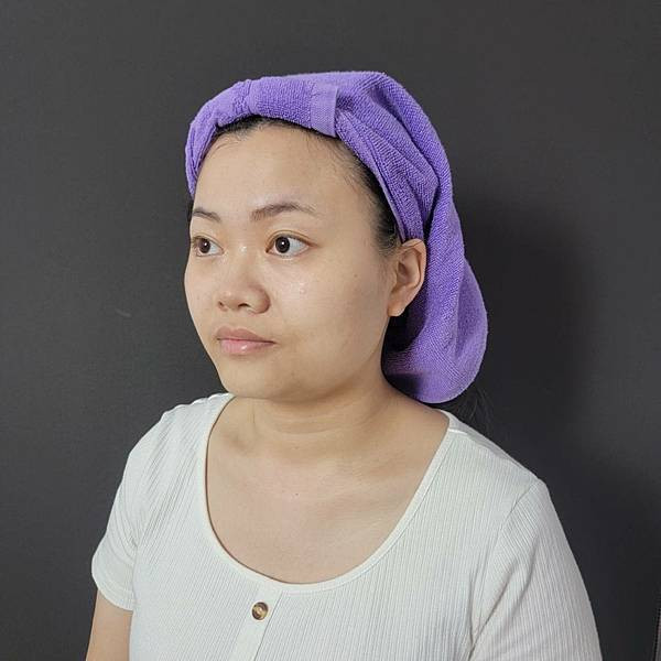 板橋醫美改善膚質美白效果有效嗎台北美白皮秒心得 - 愛爾麗診所板橋分店 (11).jpg
