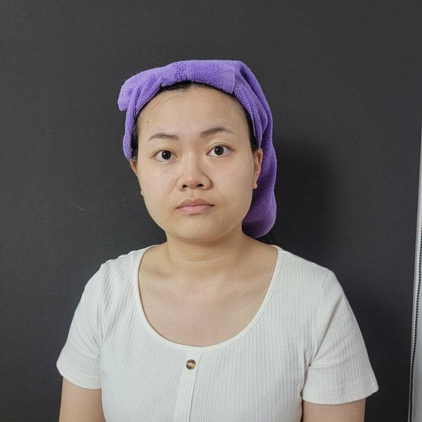 板橋醫美改善膚質美白效果有效嗎台北美白皮秒心得 - 愛爾麗診所板橋分店 (14).jpg