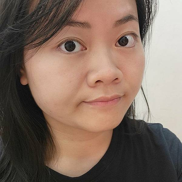 板橋醫美改善膚質美白效果有效嗎台北美白皮秒心得 - 愛爾麗診所板橋分店 (4).jpg