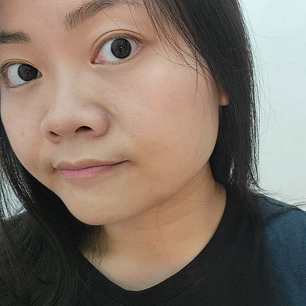 板橋醫美改善膚質美白效果有效嗎台北美白皮秒心得 - 愛爾麗診所板橋分店 (2).jpg